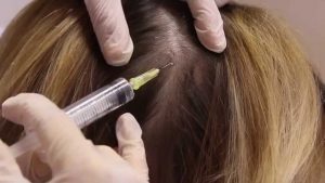 mesotherapie cheveux Turquie