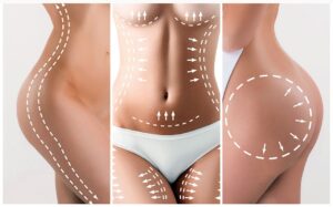 chirurgie lipofilling turquie